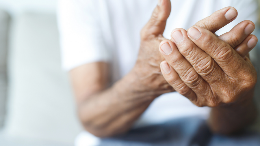 Hands suffering from arthritis
