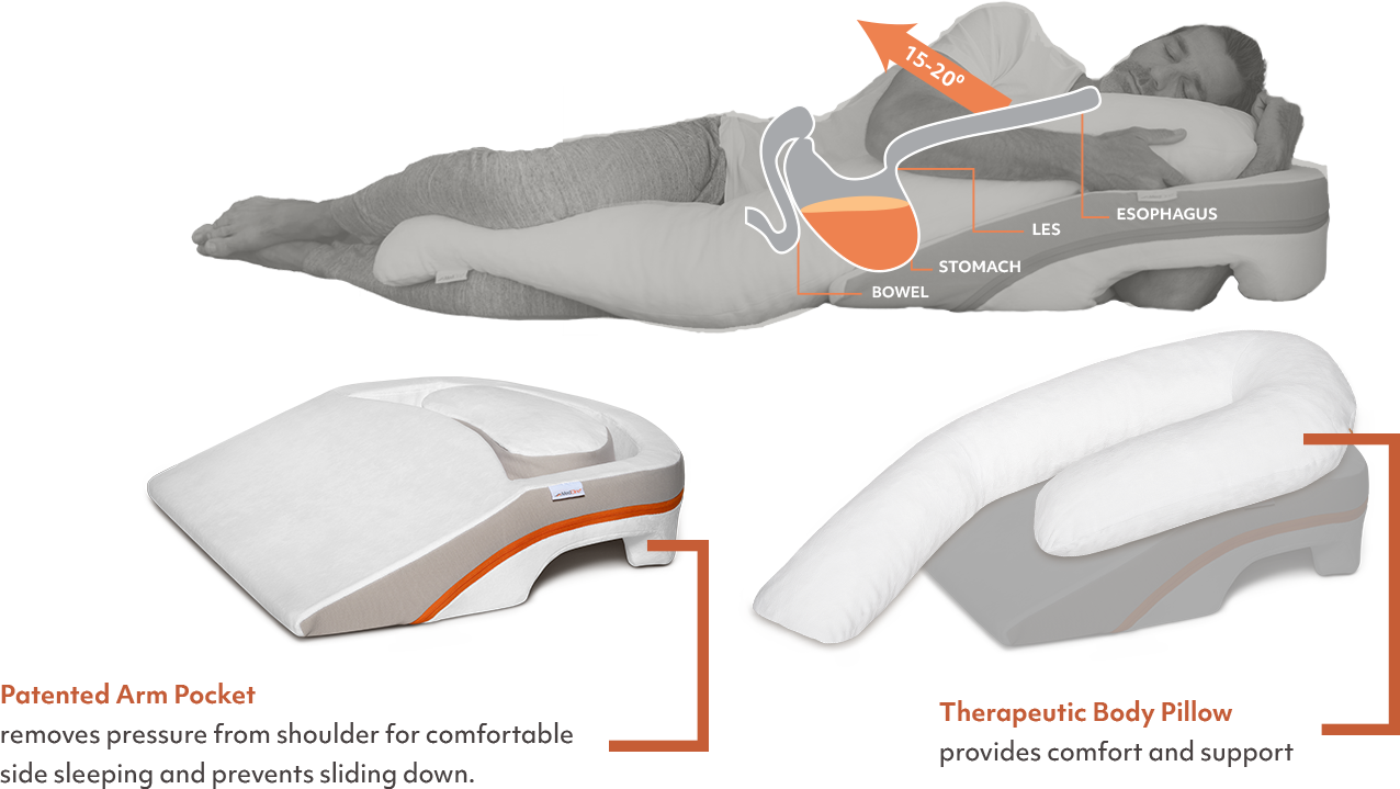 Reflux relief silhouette positioning diagram